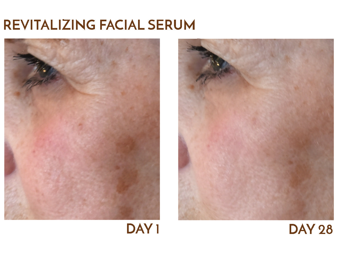 Revitalizing Facial Serum before & after